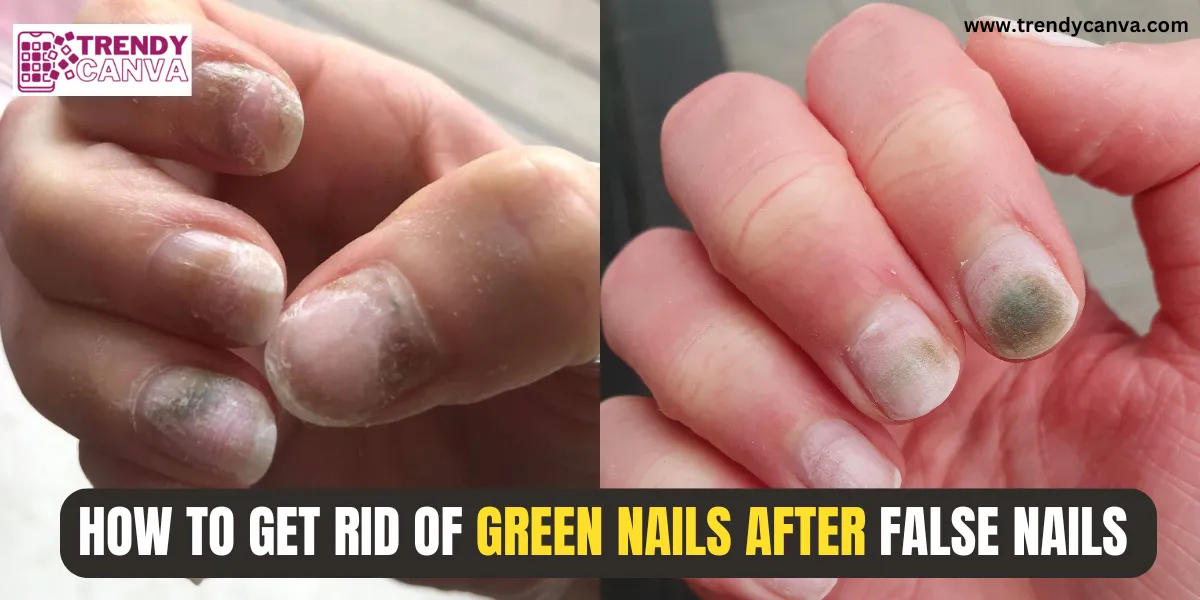 How To Get Rid of Green Nails After False Nails