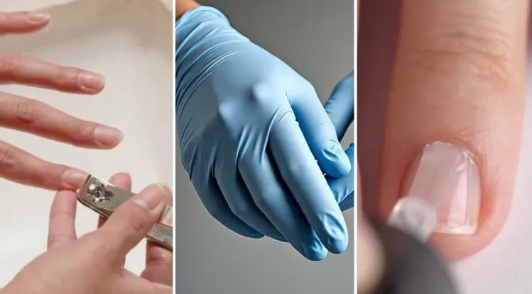 Prevention Strategies for Stop Nail Biting For All Ages