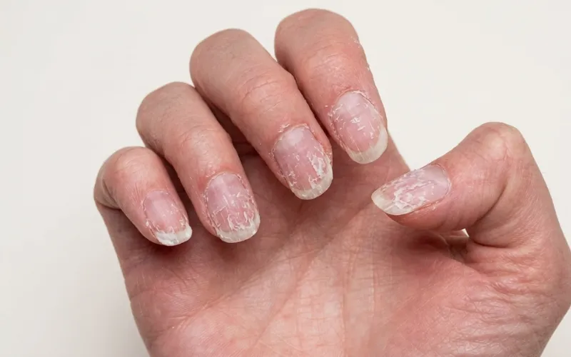 Stop the damage Nails