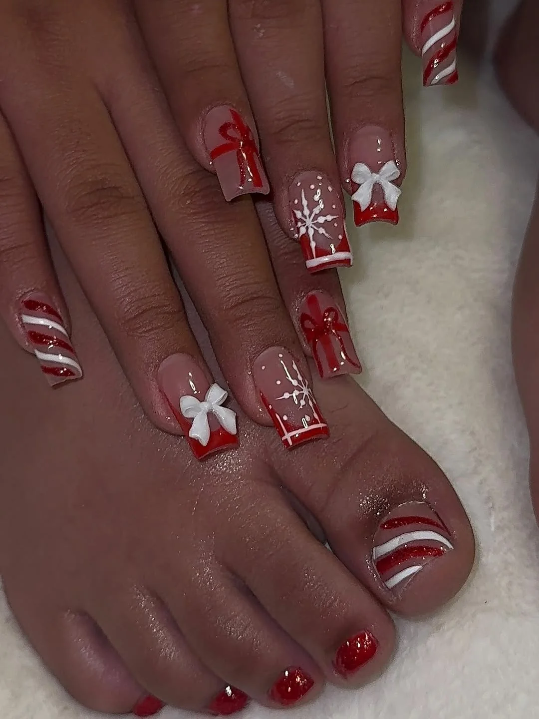 Red and white holiday toes with candy cane stripes and bows
